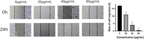 Figure 4 The effect of SCU on the migration ability of HepG2 cells.