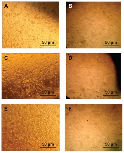 Figure 3 Cell culture of L929 on the (A) PUA1, (B) PUA2, (C) PUA3 (magnification ×100) and human dermal fibroblast on (D) PUA1, (E) PUA2, (F) PUA3 (magnification ×100).