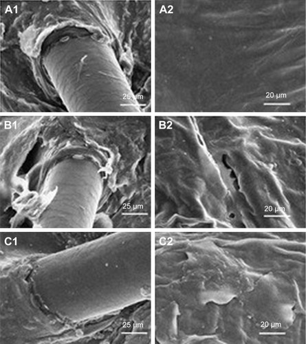 Figure 10 Scanning electron microscopy images of porcine skin.Notes: (A) Control sample without sonophoresis, (B) sonophoretic sample (20 kHz), and (C) sonophoretic sample with liposomes (20 kHz).Reproduced with permission from Taylor and Francis (http://www.tandfonline.com). Rangsimawong W, Opanasopit P, Rojanarata T, Panomsuk S, Ngawhirunpat T. Influence of sonophoresis on transdermal drug delivery of hydrophilic compound-loaded lipid nanocarriers. Pharmaceutical Development and Technology. 2017;22(4):597–605.Citation54