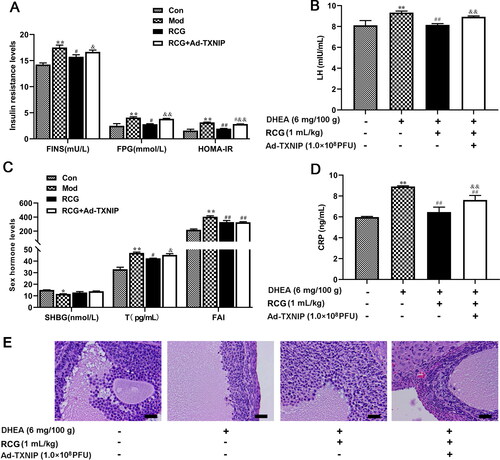 Figure 5. R. chingii treatment restored the ovary disorder through TXNIP/NLRP3 pathway. PCOS rats were co-treated with R. chingii followed by injecting with AD-TXNIP adenovirus which was stably overexpressed TXNIP through the tail vein. (A-D) FPG was measured by Biochemical Analyzer. FINS, LH, T, CRP, and SHGB levels were detected by ELISA. HOMA-IR = FPG × FINS/22.5, FAI = T/SHBG × 100. (F) Morphological changes of ovary tissue (H&E, × 400). **p < 0.05 vs. control, **p < 0.01 vs. control, #p < 0.05 vs. PCOS, ##p < 0.01 vs. PCOS, &p < 0.05 vs. R. chingii treatment, &&p < 0.01 vs. R. chingii treatment.