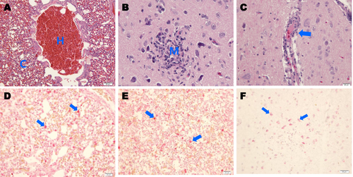 Fig. 5 Histopathological changes and immunostaining of tissues infected with A/mandarin duck/Korea/H539-3/2016 (H7N7).Photomicrographs of hematoxylin and eosin (H&E)-stained and immunohistochemically stained tissue sections collected 4 days postinfection from chickens challenged with A/mandarin duck/Korea/H539-3/2016 (H7N7) virus. a Chickens challenged with the H7N7 virus showing severe hemorrhaging (h) and congestion (c) in lung tissue (H&E stain). b Infected chickens showing focal necrosis and mononuclear-cell infiltration (m) in cerebral tissue (H&E stain). c Infected chickens showing mild perivascular cuffing (arrow) in cerebral tissue (H&E stain). d IAV NP antigens were immunostained in alveolar macrophages (arrows) in lung tissue. e IAV antigens were immunostained in macrophages of red pulp (arrows) in spleen tissue. f IAV antigens were immunostained in cerebral tissue neurons (arrows)