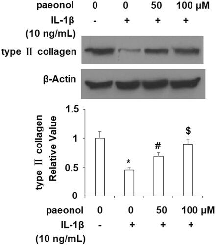 Figure 6. Paeonol ameliorates reduction of type II collagen in chondrogenic cell line ATDC5 cells. ATDC5 cells were incubated with 10 ng/mL IL-1β with or without paeonol (50, 100 μM) for 24 h. Protein level of type II collagen was measured (*, #, $, P < .01 vs. previous control group).