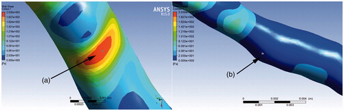 Figure 5. Coronary artery stenosis (a) and downstream segment (b).