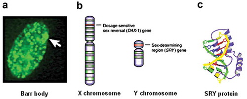 Figure 2. a. Barr body, the condensed second X chromosome[Citation17]. Photomicrograph example of normal fibroblast that was FITC-labeled using antisera to histone macroH2A1. Arrow points to sex chromatin site in the FITC-labelled photo. This file, originally published by Gartler et al. [Citation12,Citation13], is licensed under the Creative Commons Attribution 2.0 Generic license. With thanks. b. Location of genes involved in gonadal sex differentiation. The sex-determining region of the Y (SRY) gene codes for the production of the SRY protein, which causes testis differentiation. Absence of this gene in an individual lacking the Y chromosome results in the formation of ovaries. The DAX-1 gene on the X chromosome suppresses SRY gene expression in a rather complex way. Authors: Jones and Lopez 17 with thanks. Copyright permission obtained from Elsevier. c. Image of the SRY protein (in violet) partially inserted in between two DNA strands (in green and yellow). From Wikipedia: Testis-determining factor.10 Copyright permission details: File:PBB Protein SRY image.jpg, Uploaded: 3 January 2010: stated to be public domain from www.pdb.org. With thanks to the non-disclosed author.