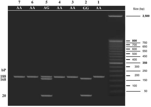 Figure 1 Agarose gel electrophoresis showing TLR-4 (Asp299Gly) genotyping by PCR -RFLP. Lane 1: wild Asp299Asp (AA) genotype at 188 bp (unrestricted); Lane 2: mutant Gly299Gly (GG) genotype at 168 and 20 bp; Lane 5: mutant Asp299Gly (AG) genotype at 188, 168 and 20bp.