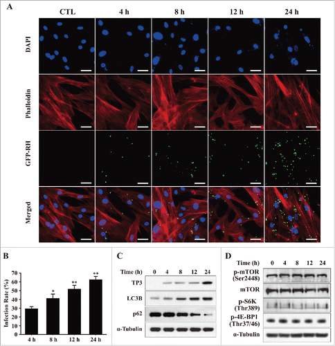 Figure 2. T. gondii infection rates and the expression levels of autophagy-related proteins in hUC-MSCs. (A) hUC-MSCs were infected with GFP-expressing T. gondii at an MOI of 5 for the indicated time durations. Cells were fixed and stained with Texas Red-X phalloidin to label F-actin (red), and nuclei were stained with DAPI (blue). Scale bar = 100 μm. (B) The number of T. gondii-infected cells and the total number of cells were counted to calculate the infection rate. *P < 0.05, **P < 0.01 as compared with cells infected with T. gondii for 4 h. (C) Cell lysates were subjected to western blotting using autophagy-related antibodies (LC3B and p62) and a T. gondii-specific antibody (TP3). (D) The expression levels of p-mTOR, mTOR and its downstream effectors S6K1 (phosphorylation at Thr389) and 4E-BP1 (phosphorylation at Thr37/46) were detected by western blotting. All data shown are representative of 3 independent experiments with similar results.