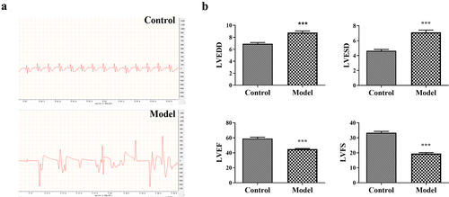 Figure 2. The cardiac function determination of Adriamycin (ADR) induced-cardiomyopathy model rats. (a) The electrocardiograms of control and model rats. (b) The detection of left ventricular end-diastolic dimension (LVEDD), left ventricular systolic end-diastolic diameter (LVESD), left ventricular ejection fraction (LVEF), and left ventricular fraction shortening (LVFS) in control and model rats. ***P < 0.001 vs. the control group.