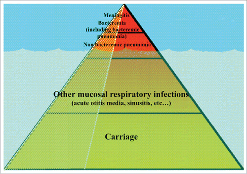 Figure 1. Spectrum of pneumococcal infections.