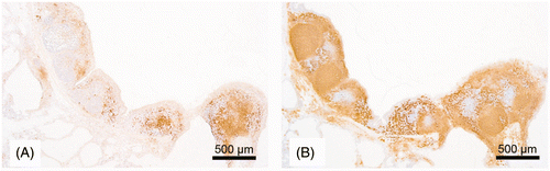 Figure 3. Section showing fully developed BALT. A: B cell staining. B: CD4 T cell staining (adapted from Kothlow and Kaspers 2008, with permission from Elsevier).