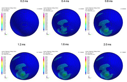 Figure 9 Sequential strain strength response of ocular surface of model eye upon airbag impact in 30°-gaze down position at 40 m/s with adhesion strength of scleral flap of 30%, shown at 0.4-ms intervals after 0.2 ms. Strain strength change is displayed in color as presented in the color bar scale (Figure 2).