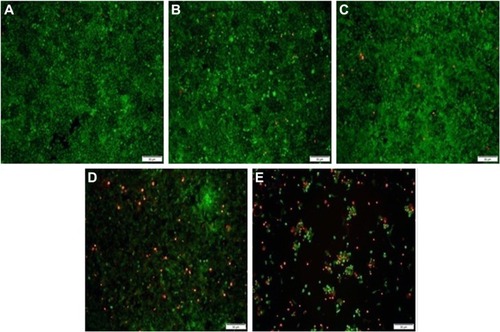 Figure 8 Live/Dead assay of PC-3 cells treated with different nanocomplexes for 24 h: (A) control; (B) DOX-Duplex; (C) PEI25K/DOX-Duplex; (D) PEI25K/siRNA and (E) PEI/DOX-Duplex/siRNA.Notes: The live and dead cells exhibited green and red fluorescence, respectively. Scale bar 200 µm.Abbreviations: DOX, doxorubicin; PEI, polyethylenimine.