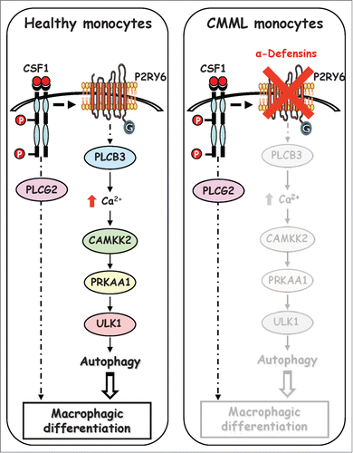 Figure 8. Schematic view of the signaling pathways involved in healthy and CMML monocytes during CSF1-induced differentiation. Upon CSF1 binding, the CSF1R triggers the activation of the P2RY6-PLCB3-CAMKK2-PRKAA1-ULK1 pathway leading to induction of autophagy and human monocyte differentiation. In a CMML-dependent context, immature dysplastic granulocytes synthesize and secrete large amounts of α-defensins DEFA1 and DEFA3, which antagonize P2RY6 and inhibit CSF1-induced differentiation of monocytes.