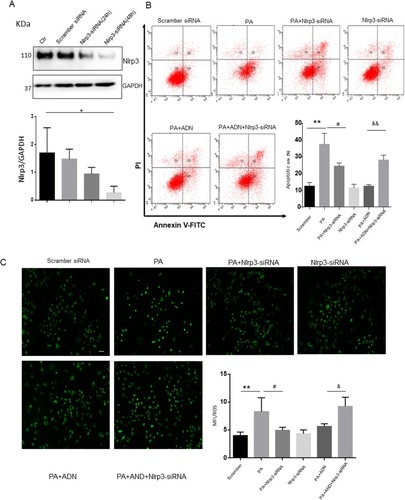 Figure 7 Nlrp3 blockade ameliorated PA-induced cell apoptosis and ROS generation in H9c2 cells. H9c2 cells were cultured in 100 μM PA with or without pretreatment of Nlrp3 siRNA. Protein expression was detected with Nlrp3 siRNA incubation in 24 h and 48 h (A). Cell apoptotic rate was detected by flow cytometry (B). ROS was measured by fluorescent staining (C). Data were presented as the mean ± SD from three separate experiments. *P < 0.05 vs Ctr group; **P < 0.01; #P < 0.05 vs PA treatment; &P < 0.05, &&P < 0.01 vs PA +ADN treatment. Bar = 50 µm.