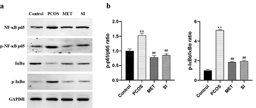Figure 6. Effect of soy isoflavones on NF-κB signaling pathway in ovarian tissue of PCOS rats