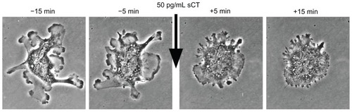 Figure 2 Rapid inhibition of osteoclast motility after treatment with salmon calcitonin (sCT) in vitro.