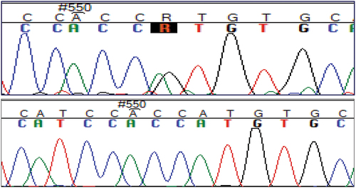 Figure 6. Chromatogram showing T7488C (rs763780) SNP in IL17F (ambiguity code: R).