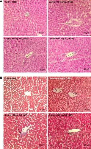 Figure 6 Morphological alteration of liver.Notes: Effects of TiO2 NPs on histological changes of liver determined by H&E (A) and MT staining (B) (magnification, 400×). Arrow indicates collagen deposition and straight line shows central vein diameter.Abbreviations: MT, Masson’s trichrome; TiO2 NPs, titanium dioxide nanoparticles; H&E, Hematoxylin and Eosin.