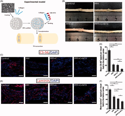 Figure 8. (A) Schematic representation of conduit containing PPF, collagen, and CBD-NT3 for treatment of peripheral nerve injury. (B) The greatest connectivity and integration with a normal spinal cord was found for the PPF + C+NT3 group. (C,D) The highest reduction of the chondroitin sulfate proteoglycans (CSPGs) as an inhibitor of regeneration was observed in the PPF + C+NT3 group. (E,F) The highest reduction of fibrotic scarring (Laminin) was observed in the PPF + C+NT3 group [Citation80].