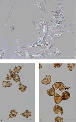 Plate 2. Three low-magnification photomicrographs of microscope slides distributed by Bill Evitt at his Teaching Conferences on Fossil Dinoflagellates (section 10).Figure 1. A group of several dissected plates of Ceratium hirundinella from a lake in California. The thecae were treated with sodium hypochlorite solution to dissociate the plates; hence, individual elements can be studied in detail. This is Stanford University palynology sample PL 5134. The England Finder coordinate is L35/3 and the image was taken using differential interference contrast (DIC). This slide was distributed at the 20th course held at Sunbury-on-Thames, England, between 10 and 21 August 1981. Ceratium hirundinella is discussed in more detail in the caption to Plate 1. The elongate oblong object in the top right is a diatom referable to the genus Aulacoseira; it is probably Aulacoseira granulata. The scale bar represents 25 μm.Figure 2. A group of several specimens of Gonyaulacysta dualis from the Upper Jurassic Naknek Formation of Amber Bay, southwest Alaska. This is Stanford University palynology sample PL 5002; the England Finder coordinate is G38/1. The slide was distributed at the 20th course held at Sunbury-on-Thames, England, between 10 and 21 August 1981. This sample clearly yielded a virtually monospecific assemblage of Gonyaulacysta dualis, which is discussed in more detail in the caption to Plate 15. The scale bar represents 100 μm.Figure 3. A group of several specimens of Leptodinium mirabile from the Upper Jurassic Naknek Formation of Amber Bay, southwest Alaska. This is Stanford University palynology sample PL 5004; the England Finder coordinate is M40. The slide was distributed at the 29th course held at Glasgow, Scotland, between 19 and 30 August 1985. Sample PL 5004 produced a palynoflora overwhelmingly dominated by Leptodinium mirabile; rare specimens of Gonyaulacysta dualis are also present. Leptodinium mirabile is discussed in more detail in the caption to Plate 14. The scale bar represents 100 μm.