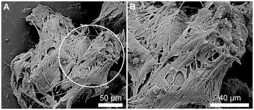 Figure 8 SEM images illustrating the NOM cells attached to the bFGF-γ-Fe2O3/MCs aggregates before being transferred to the magnetic fibrin scaffolds. (B) represents higher magnifications of the circulated area shown in (A).Abbreviations: bFGF, basal fibroblast growth factor; MC, chitosan microcarriers; NOM, nasal olfactory mucosa; SEM, scanning electron microscopy.