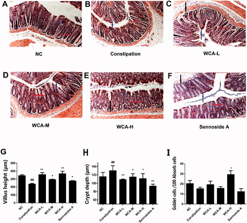 Figure 4. Effect of WCA on pathological changes in CDT-induced constipation rats. HE staining was performed in colonic tissue from rats. The morphology of colonic structure was captured and labelled for intestinal velvet (blue arrows), Goblet cells (red arrows) and crypt (black arrows). Representative image of constipation group, WCA-L, WCA-M, WCA-H and sennoside A group were shown. (A–F, n = 6). (H) villus height (µm); (i) crypt depth (µm); (g) goblet cells/100 absorb calls (n = 10). Scale bars 100 µm.