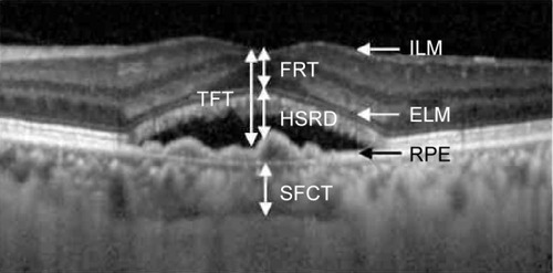 Figure 1 Diagram of the structures measured.