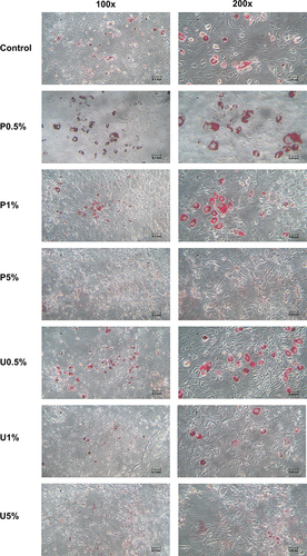 Figure 6 Microscopic pictures of 3T3-L1 cells after Oil red O staining on day 11 of differentiation under the treatment of plain yogurt supernatant (P) and purple sweet potato synbiotic yogurt supernatant (U). P0.25%: 0.25% plain yogurt, P0.5%: 0.5% plain yogurt, P1%: 1% plain yogurt, P5%: 5% plain yogurt, U0.25%: 0.25% purple sweet potato yogurt, U0.5%: 0.5% purple sweet potato yogurt, U1%: 1% purple sweet potato yogurt, U5%: 5% purple sweet potato yogurt.