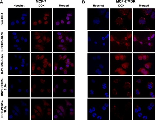 Figure 5 LSCM images of (A) MCF-7 and (B) MCF-7/MDR cells co-incubated with various preparations at 37°C for 6 hours with a final DOX concentration of 20 μM. Nuclei of cells were stained with Hoechst 33258.Abbreviations: LSCM, laser scanning confocal microscopy; MDR, multidrug resistance; DOX, doxorubicin; C-PEG2k/5k-SLNs, cholesterol- poly(ethylene glycol)2000/5000-solid lipid nanoparticles; DSPE-PEG2k/5k-SLNs, 1,2 distearoyl-sn-glycero-3-phosphoethanolamine-N-[methoxy(polyethylene glycol)]2000/5000-solid lipid nanoparticles.