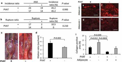 Figure 5. Effect of PVAT removal on the development of AAA. (a) The incidence ratio of AAA (b) The effect of the removal of PVAT on AAA rupture ratio. (c) Representative images of the abdominal aorta on day 21 after the induction of hypoperfusion, and day 21 after the induction of hypoperfusion with the removal of PVAT (scale bar = 1.5 mm). (d) Dilation ratio of the aortic wall. (e-h) Representative images of picrosirius red (PSR) staining (scale bar = 50 µm). (i) Quantification of collagen positive area. The vascular wall with the induction of hypoperfusion (day 21) (n = 19), and PVAT-removed vascular wall with induction of hypoperfusion (day 21) (n = 14).