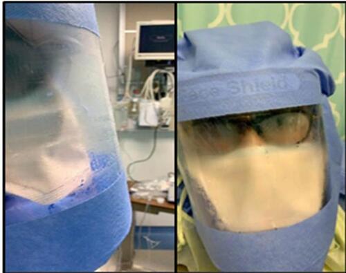 Figure 5 Protective hood would fog up with perspiration after a few minutes of being worn.