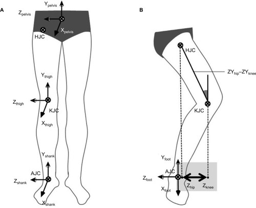 Figure 1 (A) Anatomical coordinate systems of the pelvis, thigh and shank segments; (B) depiction of the calculation of the thigh tilt and knee-hip distance variables.