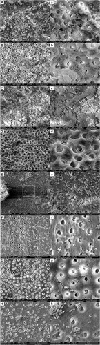 Figure 7 Representative FE-SEM images showing colonization of E. faecalis on the pretreated root canal walls (capital letters: ×3000 magnification; small letters: ×10,000 magnification).Notes: (A and a) Negative control group; (B and b) CH group; (C and c) MCSNs group; (D and d) Ag-MCSNs group; (E and e) Zn-MCSNs group; (F and f) Ag/Zn(1:9)-MCSNs group; (G and g) Ag/Zn(1:1)-MCSNs group; (H and h) Ag/Zn(9:1)-MCSNs group.Abbreviations: FE-SEM, field emission scanning electron microscopy; CH, calcium hydroxide; MCSNs, mesoporous calcium-silicate nanoparticles; Ag-MCSNs, nanosilver-incorporated MCSNs; Ag/Zn-MCSNs, nanosilver- and nanozinc-incorporated MCSNs; Zn-MCSNs, nanozinc-incorporated MCSNs.
