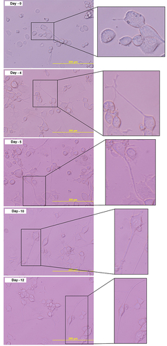 Figure 3 Morphological examination of the F11 cell line differentiation. Cell culture on day 5 shows the complete morphological features of the neuron.