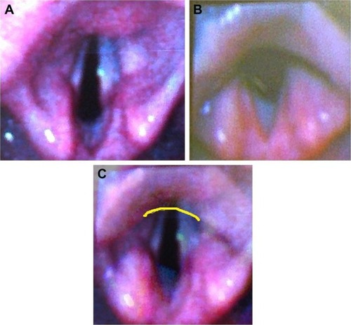 Figure 1 Images electronically processed from patient number 3.