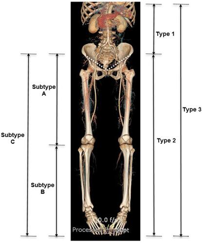 Figure 1 Three types of atherosclerosis and three subtypes of atherosclerosis. In computed tomography angiography, the dashed lines represent the inguinal ligaments between the right and left anterior superior iliac spines and pubic tubercle.