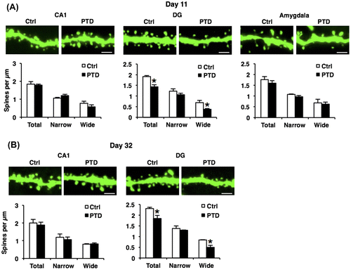 Fig. 5. Decreased dendritic spine density on hippocampal DG neurons in PTD mice.
