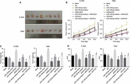 Figure 10. Tumor formation in nude mice illustrates that upregulation of miR-129-5p inhibits tumor growth and angiogenesis ability of nude mice in vivo.Note: A, the images of xenograft tumors of C-33A cells and Hela cells in nude mice for 14 d; B, the curve of tumor volume changes in nude mice transplanted with C-33A cells and Hela cells at different times; C, changes of tumor weight after transplanted with C-33A cells and Hela cells for 14 d; D, changes of MVD after transplanted with C-33A cells and Hela cells for 14 d; F, changes of MVD after transplanted with Hela cells for 14 d; NC, negative control; miR-129-5p, microRNA-129-5p; MVD, microvascular density; *, p < 0.05 compared with the blank and NC groups; #, p < 0.05 compared with the miR-129-5p inhibitor group.