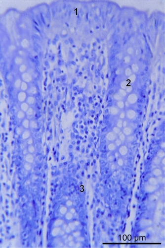 Figure 11 Colon mucosa of IBS patient (1 – columnar epithelium, 2 – goblet cells, 3 – endocrinocytes, hematoxylin-eosin staining, bar = 100 μm).