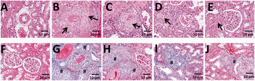 Figure 3. The effect of ethanol extract of L. paracasei subsp. paracasei NTU 101-fermented products on kidney structure in rats with hypertension-induced vascular dementia. (A–E) Hematoxylin-eosin-stained sections of the kidneys from rats treated with saline (A), DOCA-salt (B), NTU101F 0.5 (c), NTU101F 1.0 (D), and NTU101F 5.0 (E). (F–J) Masson’s trichrome-stained sections demonstrating collagen deposition (blue) in the kidneys from control (F), DOCA-salt (g), NTU101F 0.5 (H), NTU101F 1.0 (I), and NTU101F 5.0 (J) rats. Arrows and # mark inflammation and fibrosis, respectively (magnification, ×400). The meaning of abbreviations was shown in Figure. 1.