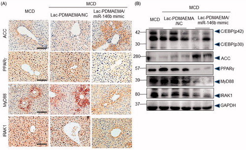 Figure 6. Downregulation of IRAK1, MyD88 and PPARγ, MyD88 and IRAK1, as well increased ACC by miR-146b in mice fed a MCD diet. (A) Immunohistochemically staining for IRAK1, MyD88, PPARγ and ACC in mice. Scale bar represents 50 μ0. (B) Representative western blots showed the protein levels of C-EBP, ACC, PPARγ, MyD88 and IRAK1 in mice. These results were normalized with GAPDH.