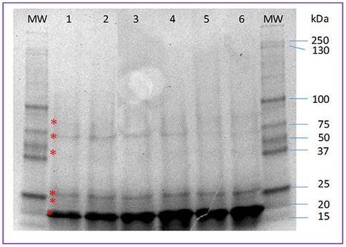 Figure 1 Protein profile of exosomes obtained from samples of patients with and without cervical intraepithelial lesion. Lanes 1–3, samples from patients without injury; lanes 4–6, samples from patients with injury. 12% SDS-PAGE. The asterisk indicates the 6 main bands found.