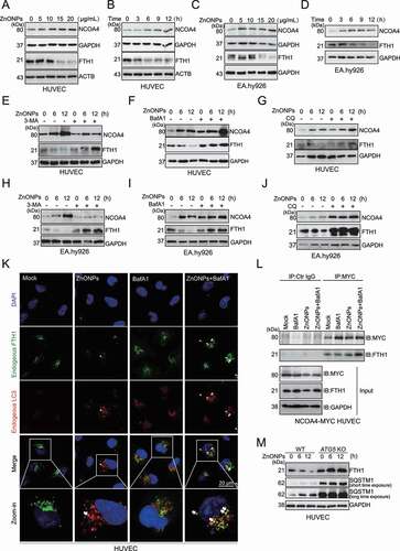 Figure 5. ZnONPs exposure led to ferritinophagy in vascular endothelial cells. (A,C) Western blotting analysis NCOA4 and FTH1 expression in (A) HUVECs or (C) EA.hy926 cells treated with 0, 5, 10, 15 and 20 μg/mL ZnONPs for 24 h. (B,D) Western blotting analysis NCOA4 and FTH1 expression in (B) HUVECs or (D) EA.hy926 cells treated with 20 μg/mL ZnONPs for 0, 3, 6, 9 or 12 h. (E,H) Western blotting analysis of FTH1 and NCOA4 expression levels in (E) HUVECs or (H) EA.hy926 cells following ZnONPs (20 μg/mL) treatment with or without 3-MA (5 mM) for 0, 6, or 12 h. (F,I) Western blotting analysis of FTH1 and NCOA4 expression levels in (F) HUVECs or (I) EA.hy926 cells following ZnONPs (20 μg/mL) treatment with or without BafA1 (100 nM) for 0, 6, or 12 h. (G,J) Western blotting analysis of FTH1 and NCOA4 expression levels in (G) HUVECs or (J) EA.hy926 cells following ZnONPs (20 μg/mL) treatment with or without CQ (5 μM) for 0, 6, or 12 h. (K) Colocalization of endogenous FTH1 (green signal) and LC3 (red signal) in HUVECs following ZnONPs (20 μg/mL) treatment with or without BafA1 (100 nM) for 24 h were determined by immunofluorescence analysis. Nuclei were counterstained with DAPI (blue signal). Images are representative of three independent experiments. Note that the white arrows indicated possible colocalization of FTH1 and LC3. (L) Immunoprecipitation analysis of NCOA4-FTH1 formation in NCOA4-MYC overexpression HUVECs following ZnONPs (20 μg/mL) treatment with or without BafA1 (100 nM) for 24 h. (M) FTH1 and SQSTM1 expression levels in WT or ATG5 KO HUVECs following ZnONPs (20 μg/mL) treatment for 0, 6 or 12 h were determined. The data are representative of three experiments