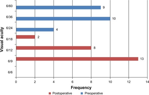 Figure 5 Comparison of pre- and postsurgical visual acuity among diabetic study participants (n = 25).