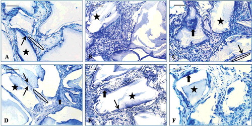 Figure 7. Toluidine blue staining: at the 2-week time point (A–C) and at the 8-week time point (D–F). EPB (A and D), PB (B and E) and B implants (C and F). Bio-Oss (star), osteoblast-like cells (long, thin arrow), multinucleated giant cells (short, thick arrow), osteoid-like tissue (ellipse).