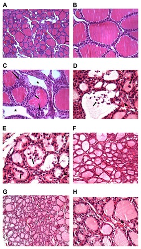 Figure 2 Photomicrographs of (A) thyroids of the control group (group 1) at low magnification, showing normal, evenly spaced follicles (H&E, 10×); (B) thyroids of the control group (group 1) at high magnification, showing follicular epithelial cells (H&E, 40×); (C) thyroids of the chromium-treated group (group 2), showing follicular hyperplasia (arrow) with large interfollicular spaces (star); (D and E) thyroids of the chromium-treated group (group 2), showing desquamated follicles (arrow) and congested interfollicular blood vessels (arrowheads) (H&E, 40×); (F) thyroids of nano-selenium-treated group (group 3), showing normal follicles; (G and H) thyroids of nano-selenium chromium-treated group (group 4).Notes: Sections show near-normal follicular structure, large and small follicles, lightly stained colloid, and reduction of interfollicular spaces. Congested blood capillaries are still present (arrowheads) (H&E, 10× and 20×, respectively).Abbreviation: H&E, hematoxylin and eosin.