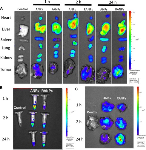 Figure 8 Biodistribution profiles of Did-loaded nanoparticles in melanoma xenograft mice. Did-loaded nanoparticles were administered via tail vein injection at an equivalent dose of 0.015 mg/kg. (A) Ex vivo fluorescence imaging of major organs at 1 hr, 2 hrs, and 24 hrs after injection. (B) Ex vivo imaging of blood at given time points. (C) Ex vivo imaging of excised tumors at the given time points.