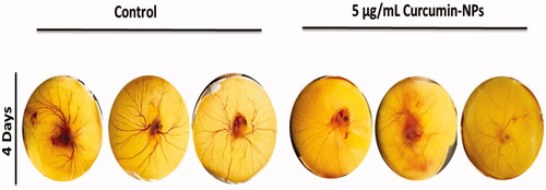 Figure 4. Effect of curcumin nanoparticles on the blood vessel formation using chick embryo. Fertile eggs were treated with and without cur-NPs and placed vertically in the trays inside the incubator for 4 days.