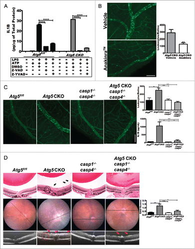 Figure 5. Blocking IL1B reverses severe uveitis. (A) The level of IL1B secreted by Atg5 CKO and floxed control peritoneal macrophages in response to LPS treatment can be reduced in both knockouts and controls by treatment with the pancaspase inhibitor, Z-VAD-FMK or CASP1and CASP4 inhibitor Z -YVAD-FMK. Two-way ANOVA (confidence level=95%) with the Bonferroni post-hoc test ****, P < 0.0001. (B) Pharmacological IL1B inhibition in Atg5 CKO mice using the IL1R (interleukin 1 receptor) antagonist Anakinra™. Representative retinal whole mounts from FITC-concavalin A lectin-perfused vehicle (n = 11) and Anakinra™ (n = 12) treated mice and quantification of adhered leukocytes per retina. Scale bar: 100 µm. Student t test **, P < 0.01 (C) Images of concavalin A lectin-perfused retinal wholemounts from control (Atg5fl/fl) (n = 6), Atg5 CKO (n = 15), casp1−/− casp4−/− knockout (n = 7) or Atg5 CKO casp1 casp4 triple-KO mice (n = 8) and quantification of adhered leukocytes in the retinal vasculature and IL1B serum levels from each group. (D). Representative histology from Atg5fl/fl control (n = 10), or Atg5 CKO (n = 14), casp1−/− casp4−/− double knockout (n = 14), and Atg5 CKO casp1−/− casp4−/− triple knockout mice (n = 14) treated with 200 ug RBP31-20 to induce EAU (top; scale bar: 200 µm) with corresponding fundus and OCT imaging, and EAU grading. Arrows indicate clusters of inflammatory cells in the vitreous and the circled areas highlight a region of retinal abnormality observed across imaging modalities. Kruskal-Wallis test with the Dunn post-hoc test *, P < 0.05; **, P < 0.01; ***, P < 0.001. All data are represented as mean ± SEM.