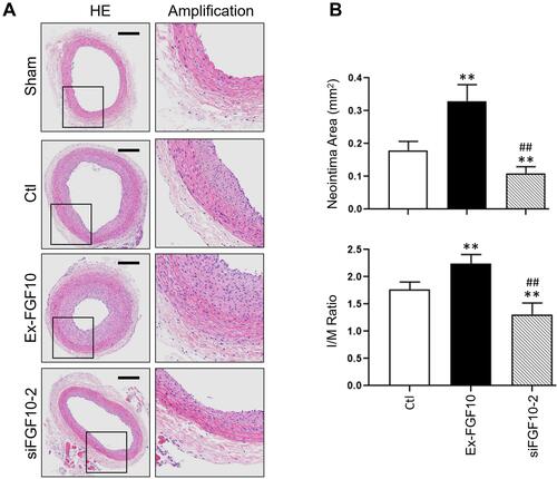 Figure 9 FGF10 potentiated balloon injury-induced neointima formation. The balloon injuries were performed in rat LCA with or without deliveries of exogenous FGF10 or siFGF10-2 and the whole LCA were harvested on day 14 post the procedure for HE staining (A) and quantitative analyses (B) of the neointima. Bar=200μm. n=6. **p<0.01 vs Ctl; ##p<0.01 vs FGF10.