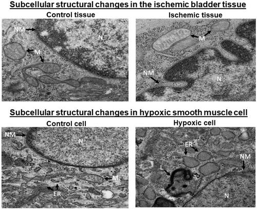 Figure 7 Transmission electron microscopy showed widespread subcellular structural changes in both ischemic bladder tissues and hypoxic smooth muscle cells versus corresponding controls. Most of these changes in the ischemic bladder tissues are consistent with apoptotic activity, characterized by shrinkage of the cell along with condensation and fragmentation of the nucleus, folding and partial disruption of nuclear membrane, chromatin condensation, degradation of mitochondrial granules and increased cytoplasmic and nuclear ribosomes. Similar structural changes consistent with apoptosis were present in the hypoxic smooth muscle cells including nuclear condensation, partial loss of nuclear membrane, chromatin condensation, swollen and splintered endoplasmic reticulum and accumulation of lysosomes. The underlying mechanism may involve degenerative responses via apoptotic processes triggered by cellular stress in both bladder ischemia and smooth muscle cells hypoxia. N = nucleus, NM = nuclear membrane, M = mitochondria, ER = endoplasmic reticulum, L = lysosome. The bladder tissue figures are reduced from 18500X. The smooth muscle cell figures are reduced from 13000X.